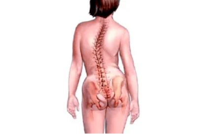 Razlozi razvoja cervikalne osteohondroze