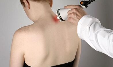 Liječenje boli u fizioterapijskim postupcima vrata