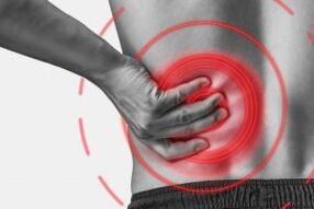 Osteohondroza lumbalne kralježnice