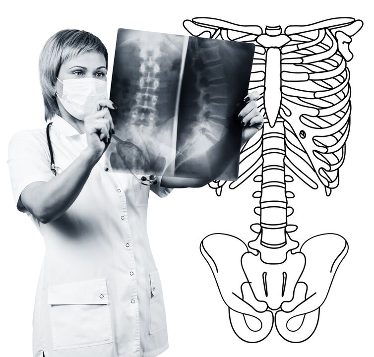 Radiografija lumbalne kralježnice