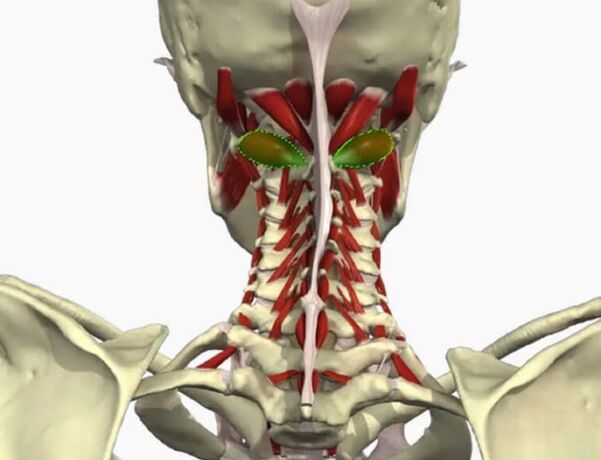Sindrom vail arterije